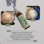 Natural Scalp Oil product image 2