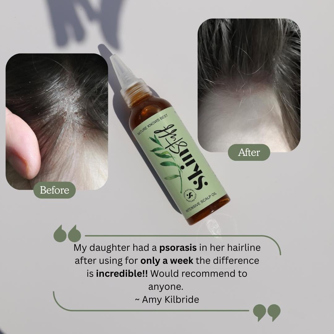 Natural Scalp Oil product image 3